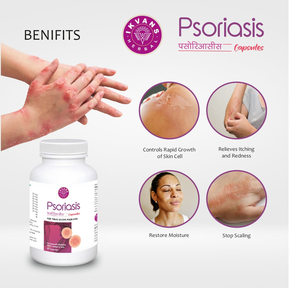 Psoriasis