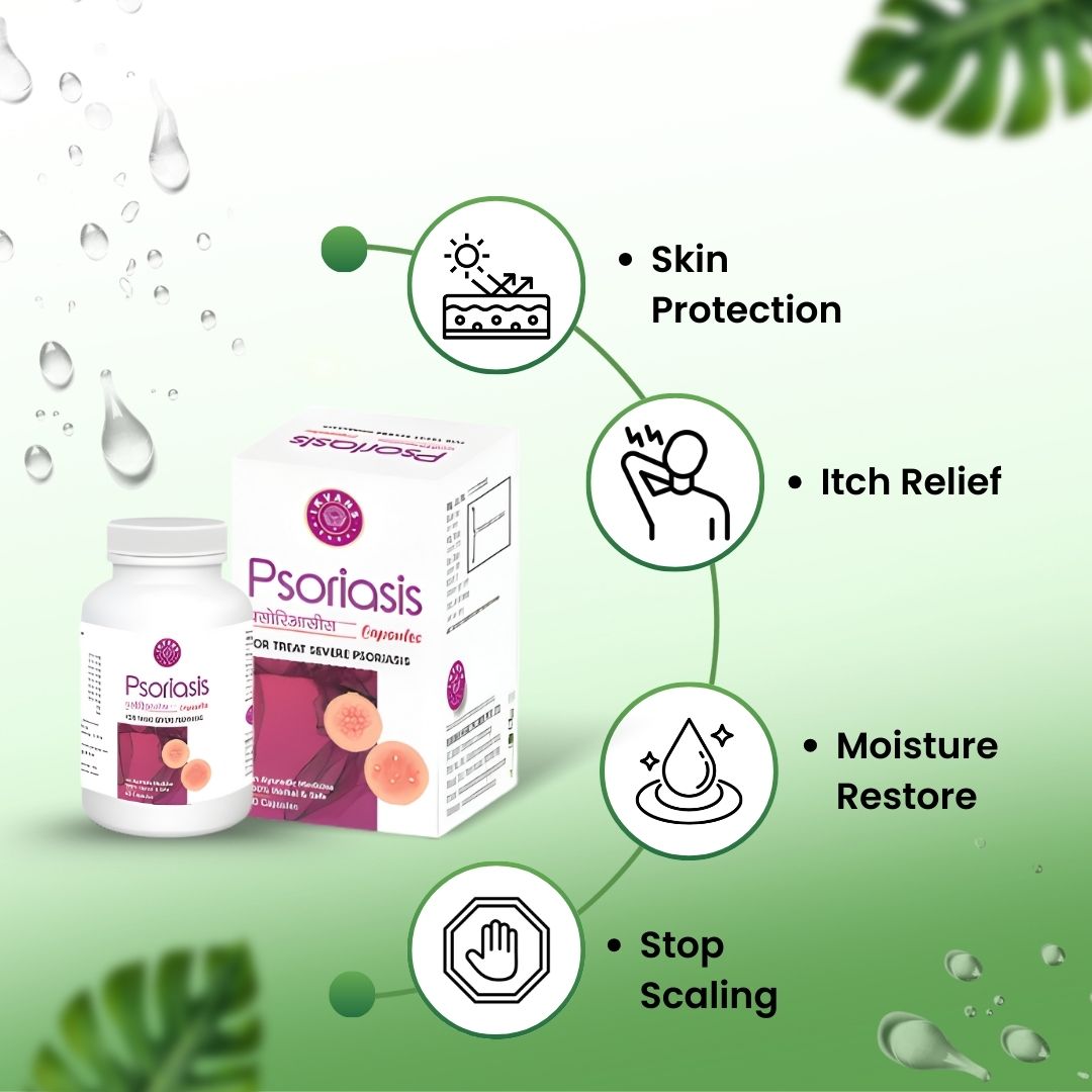 Psoriasis